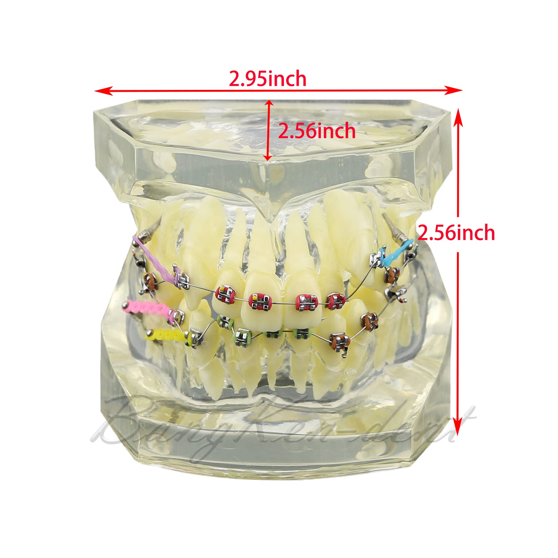 Orthodontic Typodont Dental Model with Braces, Arch Wire, Bracket & Buccal Tube - Premolar Deformity Teaching Demonstration Kit for Dental Students & Professionals (M3005-CLEAR) - Perfect for Dental School Practice, Orthodontic Training & Clinical Demonstrations