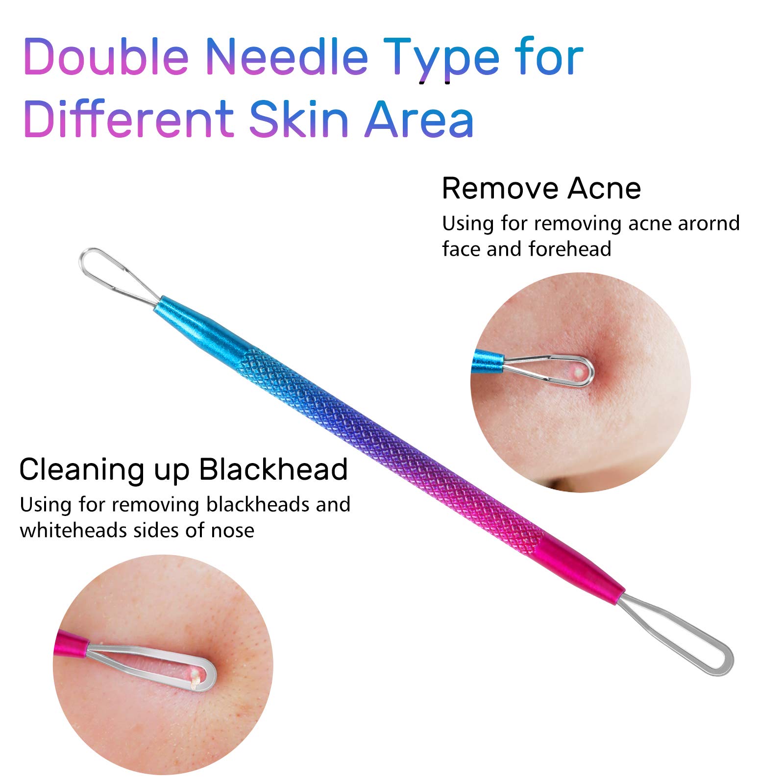 Professional Blackhead & Blemish Remover Tool Kit (3 PCS) - Stainless Steel Pimple Extractor for Acne, Whiteheads, Comedones & Ingrown Hairs | Facial Cleansing & Skin Care Essential for Spa & Home Use