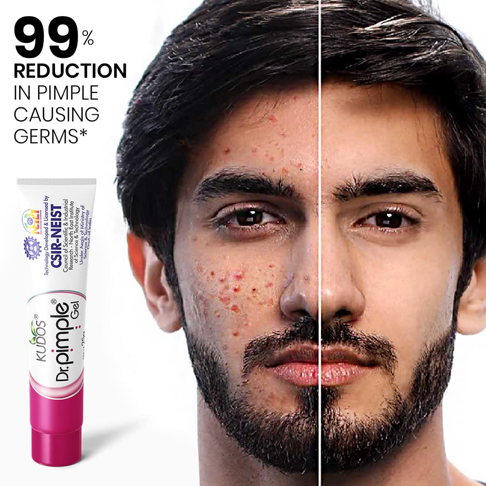 Kudos Dr. Pimple Gel - Best Ayurvedic Acne Treatment for Pimple Removal (25g X 2 Pack) | Natural Face Care Solution for Teens & Adults | Daily Skincare Routine