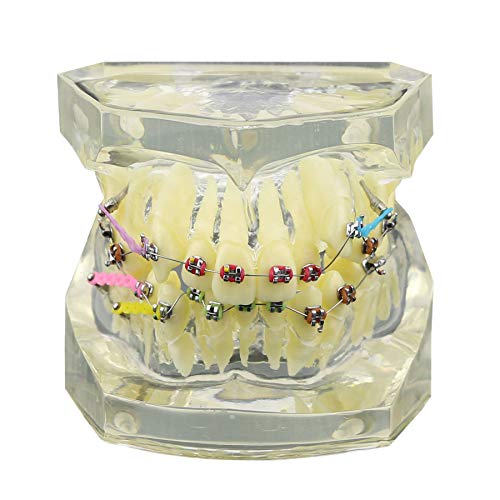 **Orthodontic Typodont Tooth Model - Standard M3005C for Dental Teaching & Training | Perfect for Dental Students, Professionals & Orthodontic Practice**