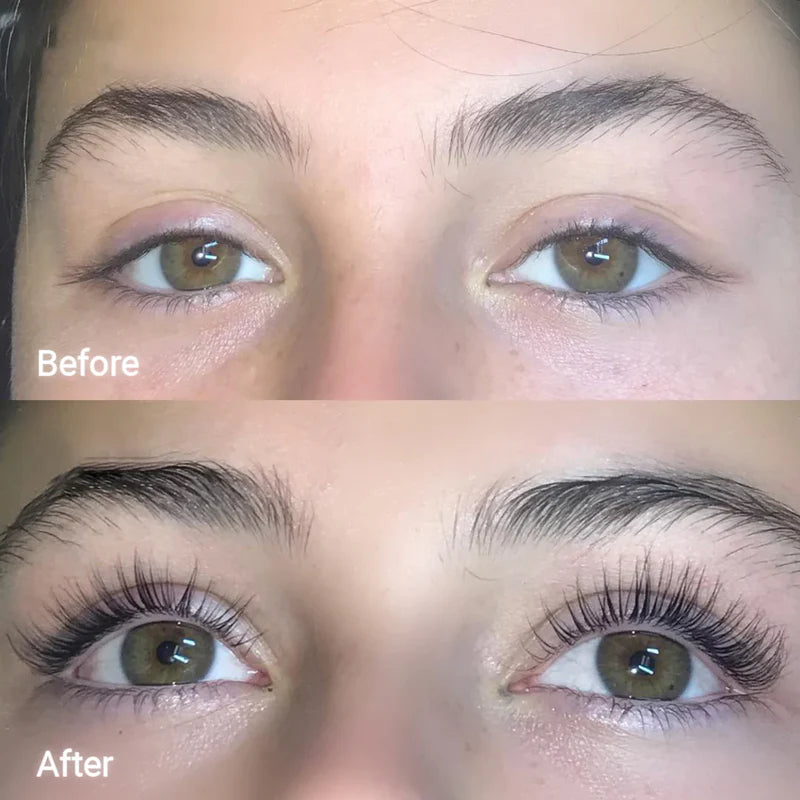 ForLash Eyelash Growth Serum - Natural & Effective Lash Enhancer for Longer, Thicker Lashes | Perfect for Nighttime Use & Daily Lash Care