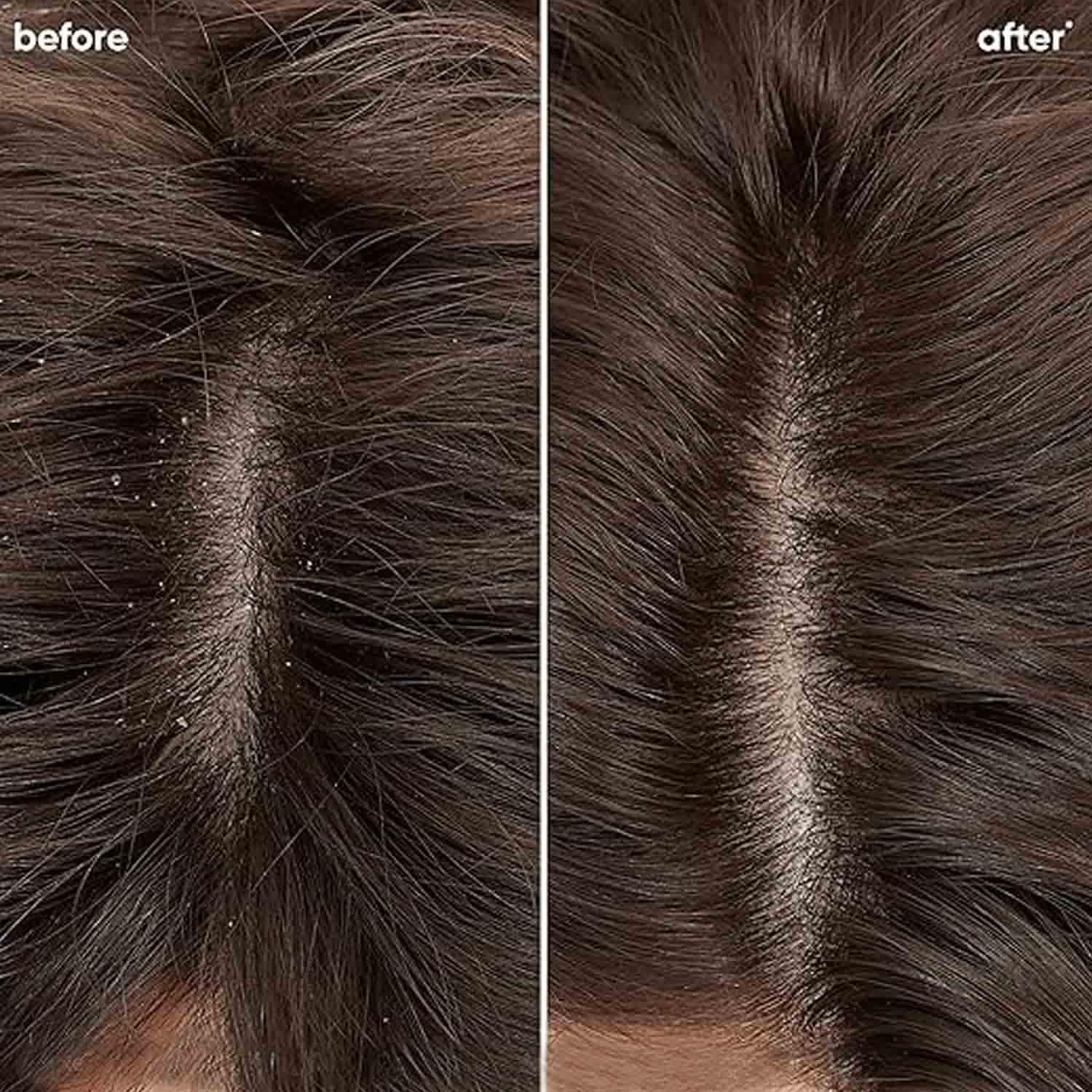 Biolage Professional Scalppure Anti-Dandruff Conditioner - Visible Flake Removal from First Use with Bergamot - Deep Scalp Treatment for Men & Women - Cruelty-Free 98g - Perfect for Dry, Itchy Scalp & Dandruff Control at Home or Salon
