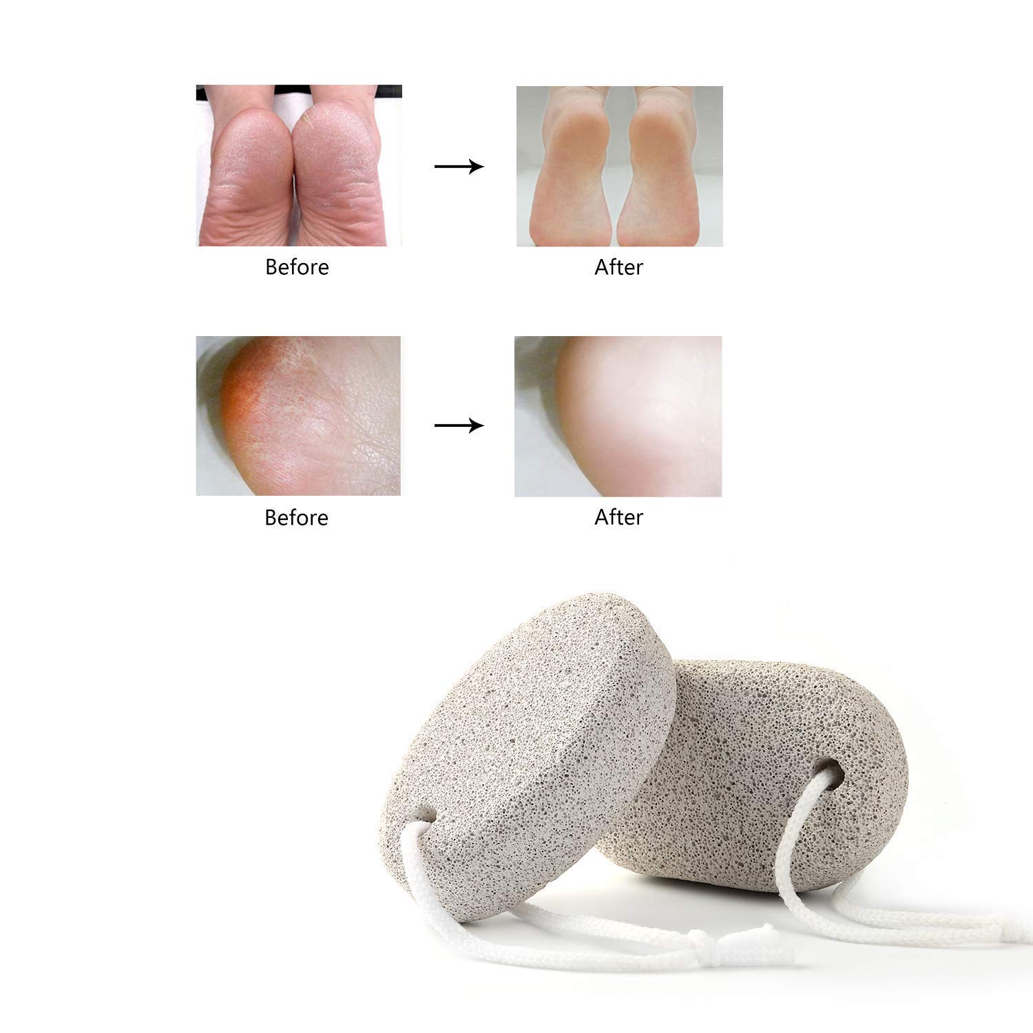 Inayaa Natural Pumice Stone for Feet - Exfoliating Foot Scrubber, Dead Skin Remover & Callus Treatment - Pack of 1 - Perfect for Pedicures, Dry Cracked Heels & At-Home Foot Care