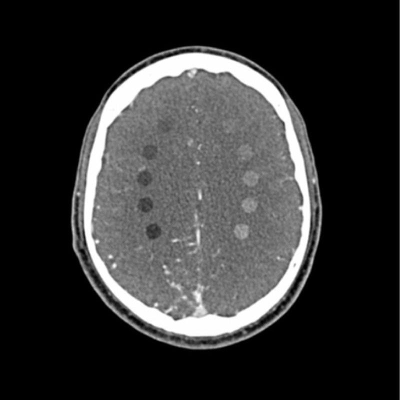 CTA AVM / Lesion Head Phantom - High-Quality CT Scan & X-Ray Training Tool for Medical Students & Radiology Professionals | Perfect for Diagnostic Imaging Practice & Medical Education