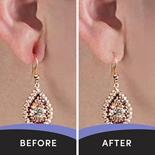 LOBE MIRACLE Earring Support Patches - 60 Count Pack for Heavy Earrings | Prevent Sagging & Stretching | Comfortable Ear Support for Daily Wear & Special Occasions