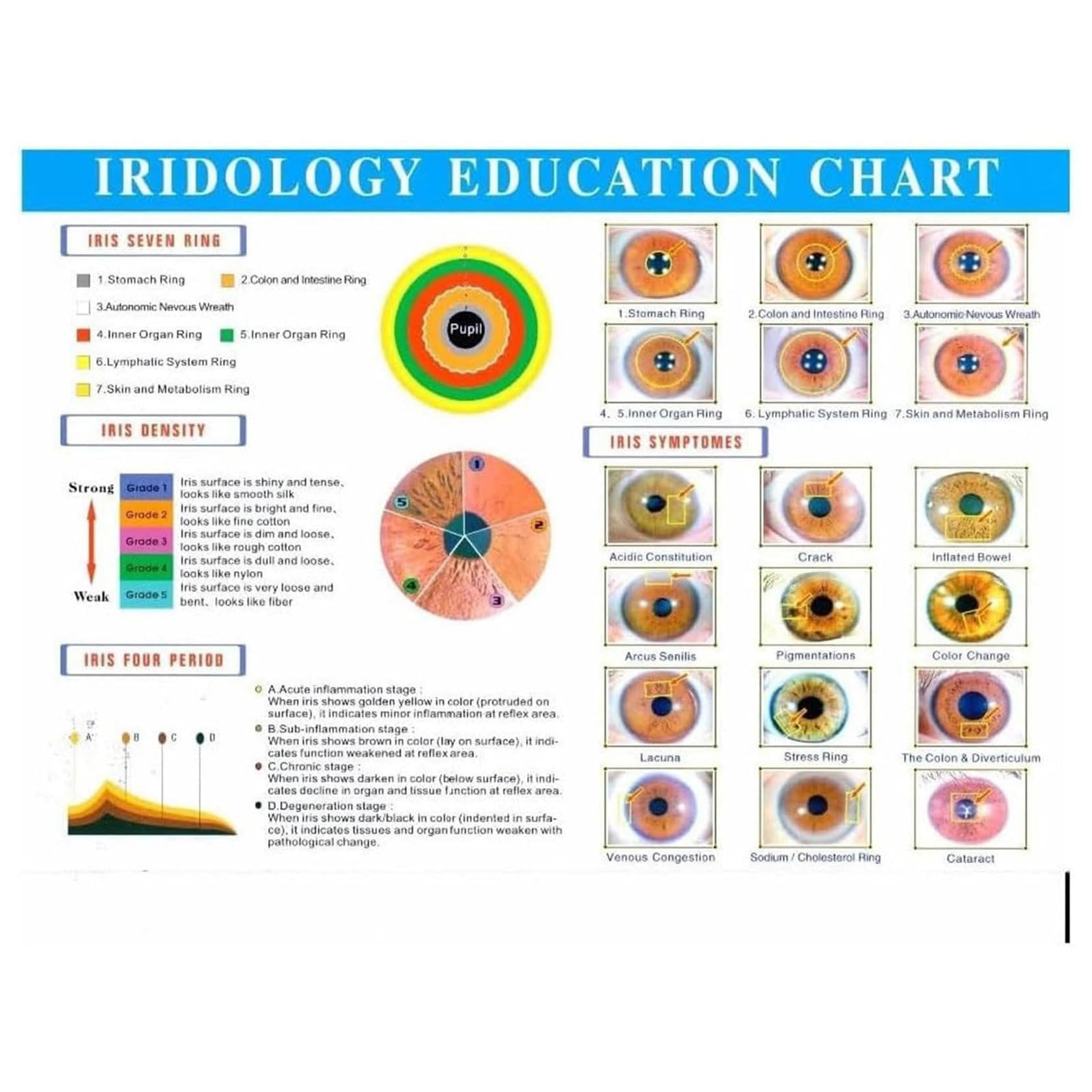 **ZHIXUMM Iridology Camera - 13MP HD Iriscope Analyzer with Aluminum Case & Analysis Software | Eye Health Detector for Beauty Salon, Spa & Holistic Therapy**