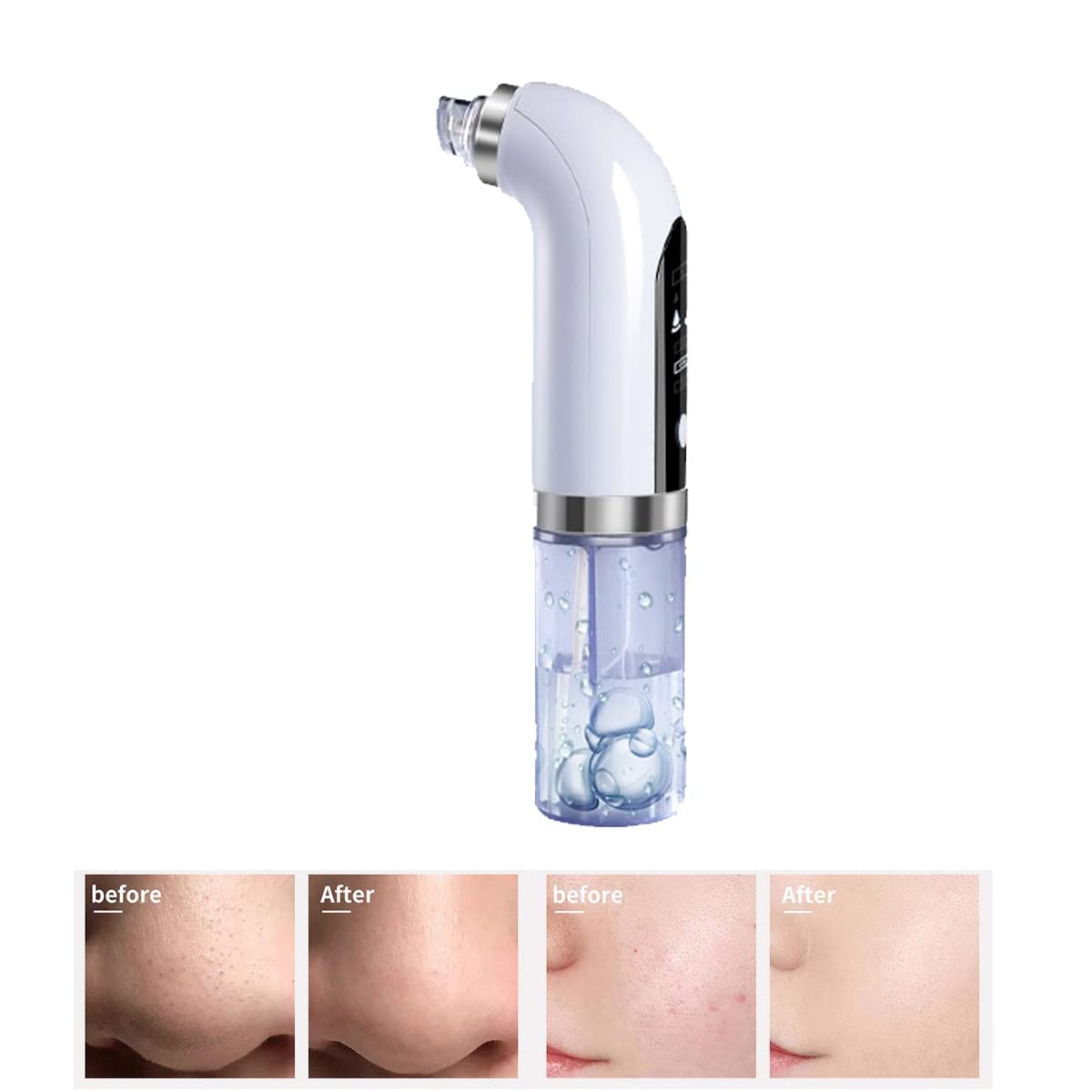 Electric Blackhead Remover Pore Vacuum - Upgraded Facial Pore Cleaner with 3 Suction Power & 6 Probes | USB Rechargeable Acne Comedone Whitehead Extractor Tool for Women & Men | Perfect for Deep Cleansing, Acne Treatment & Skincare Routine