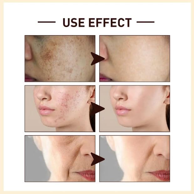 Kudh White Rice Serum for Anti-Aging & Acne - Brightening, Hydrating & Nourishing Facial Treatment (30ml) | Perfect for Daily Skincare Routine & Glowing Complexion