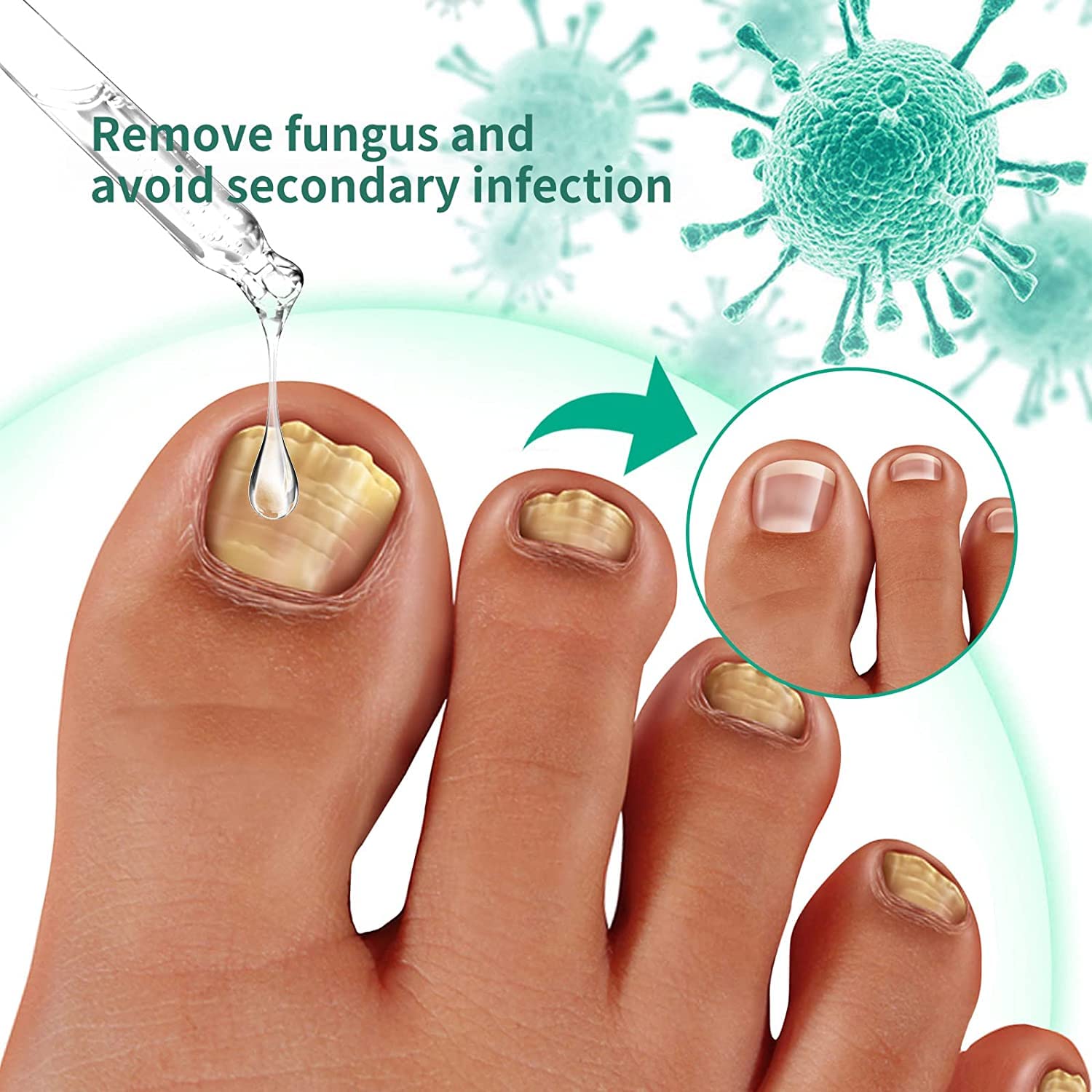 Kerassentials Toenail Fungus Treatment Oil - Healthy Skin & Nail Care Solution (1 Pack) - Effective for Athlete's Foot, Nail Fungus & Dry Skin Relief