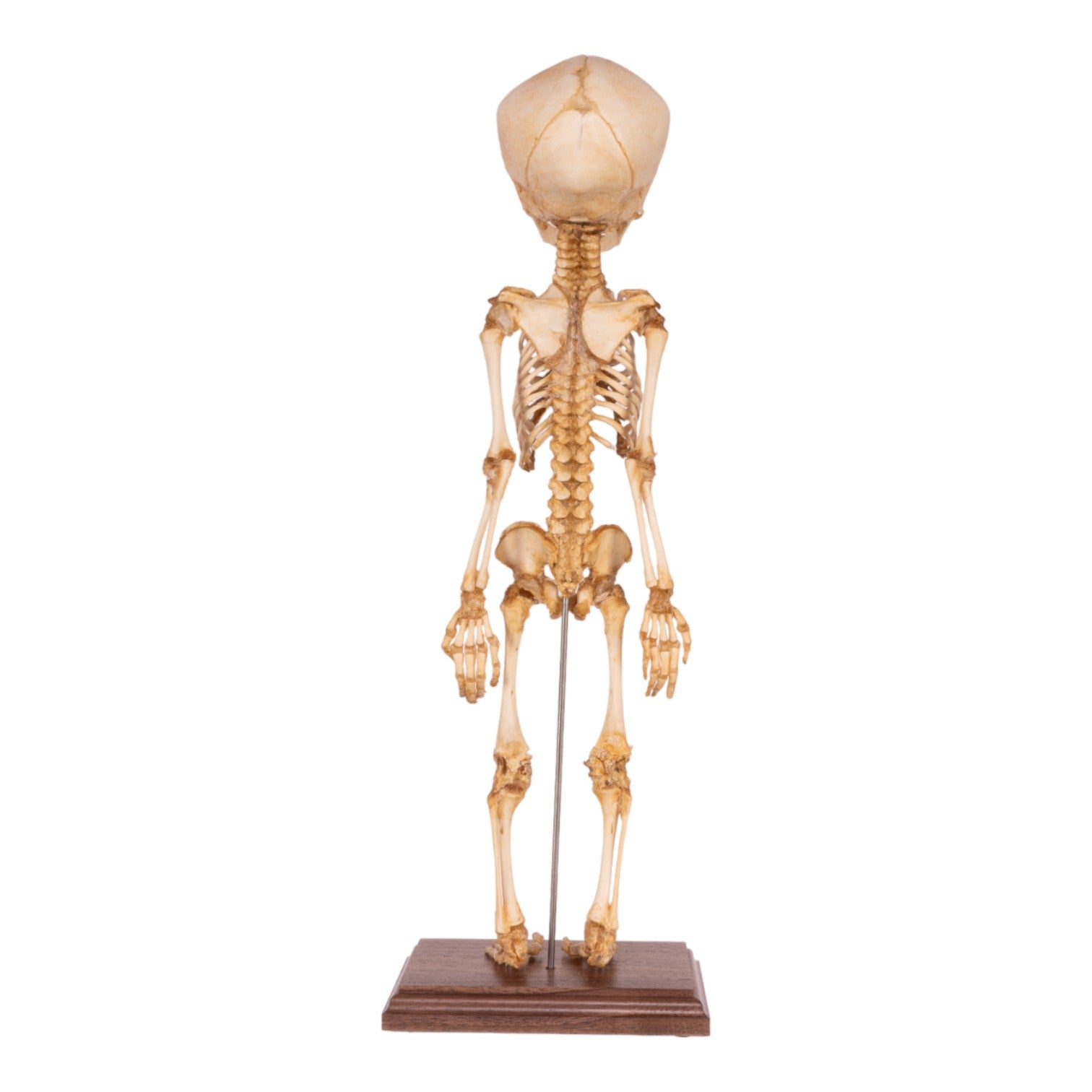 Premium Human Fetal Articulated Skeleton Model with Stand - Medical Education, Anatomy Study & Research Tool for Students and Professionals