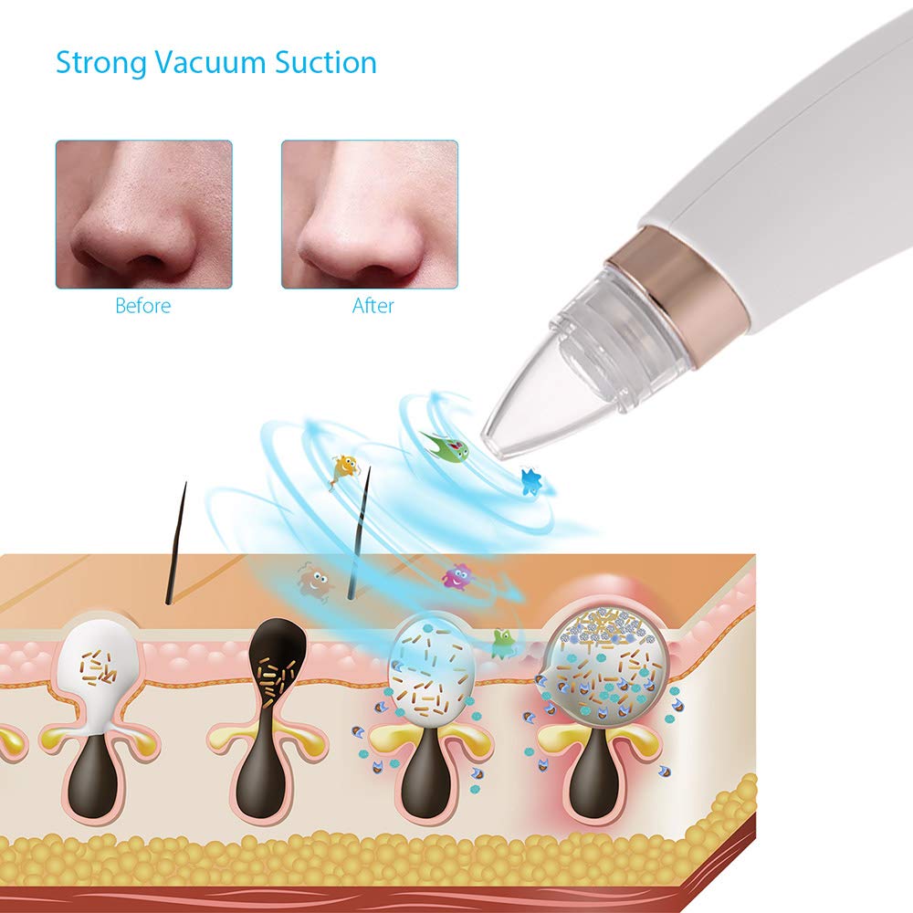 Blackhead Remover Vacuum - Electric Facial Pore Cleaner with LED Display, Comedone Extractor Kit for Deep Cleansing - Perfect for Acne Treatment & Skin Care at Home