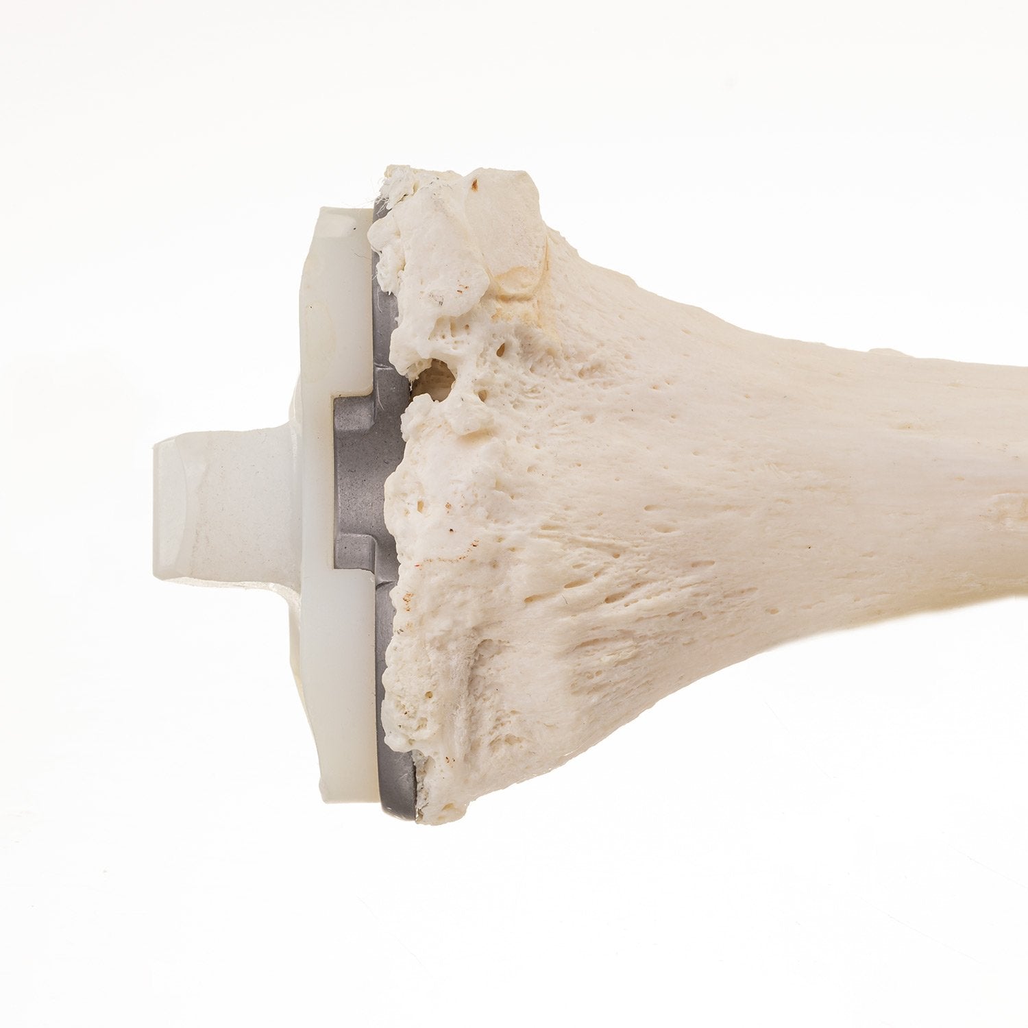 Premium Human Tibia Bone for Medical Research & Education - Ideal for Anatomy Studies, Surgical Training & Forensic Science