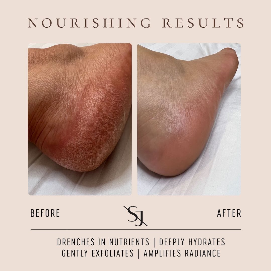 Best Luxury Body Serum for Glowing Skin - Anti-Aging & Hydrating Face & Body Treatment - Perfect for Night Routine & Spa Days
