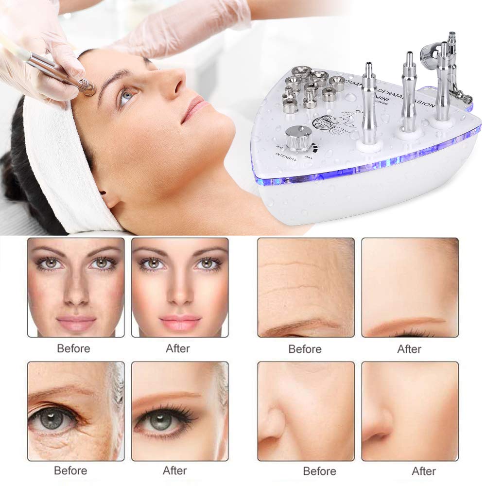 Professional Diamond Microdermabrasion Machine with Spray Gun - 65-68cmHg Strong Suction Power for Home & Salon Facial Treatments | Exfoliate, Rejuvenate & Brighten Skin | Perfect for Anti-Aging & Acne Scar Removal