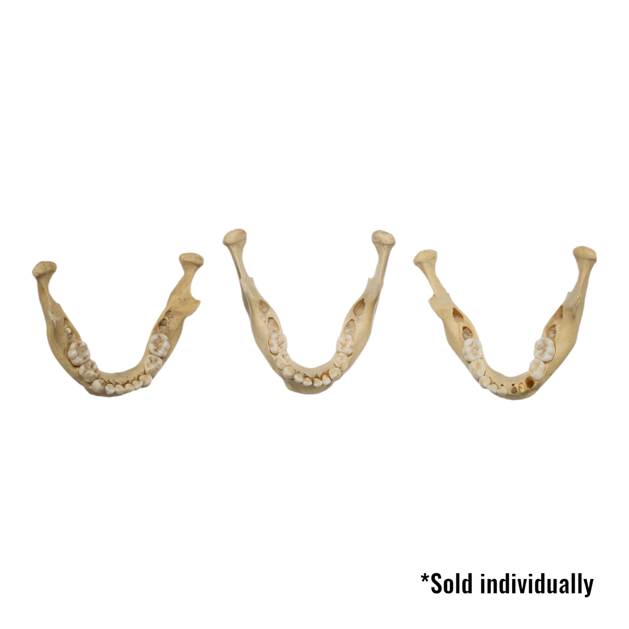 Authentic Real Human Mandible Bone - Young Adult Single Jawbone Specimen for Medical Study, Anatomy Education & Forensic Research