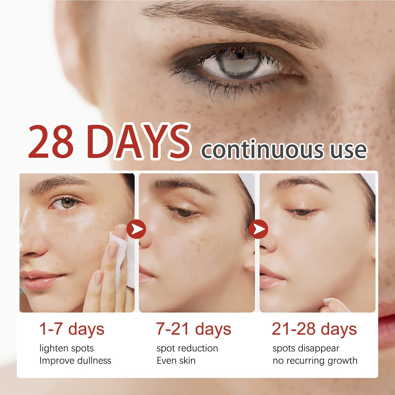 3Pcs Dark Spot Remover Cream for Face, 20g Brightening Moisturizer - Fades Hyperpigmentation & Evens Skin Tone | Perfect for Daily Skincare & Night Routine