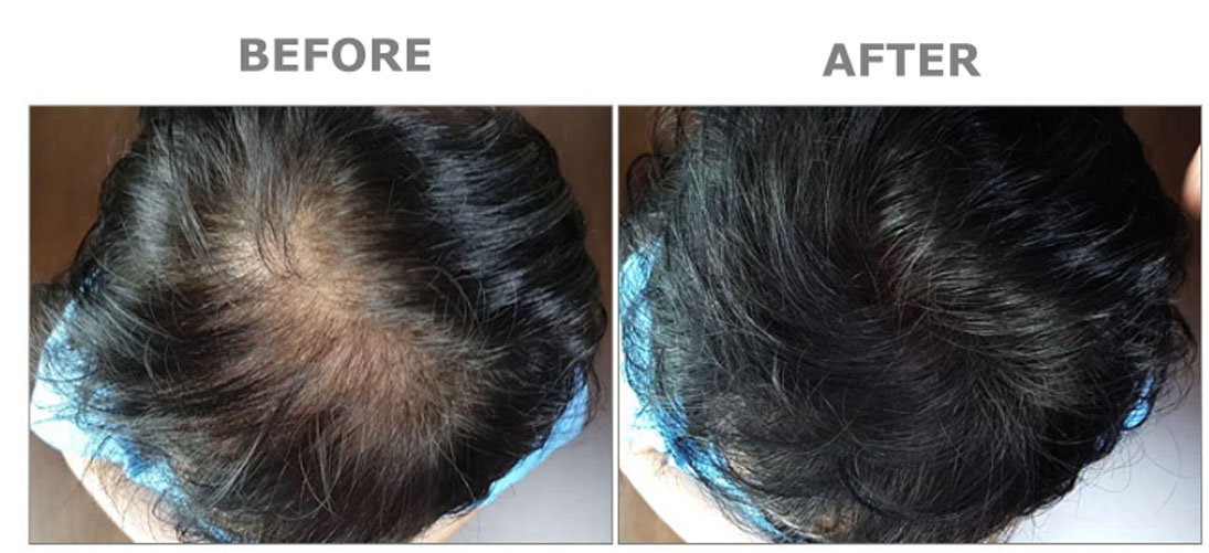 Internal Wide Hair Powder - Hair Building Fibers for Thinning Hair & Volume Boost (67g, Black) | Instant Coverage for Hair Loss | Perfect for Daily Styling & Special Occasions