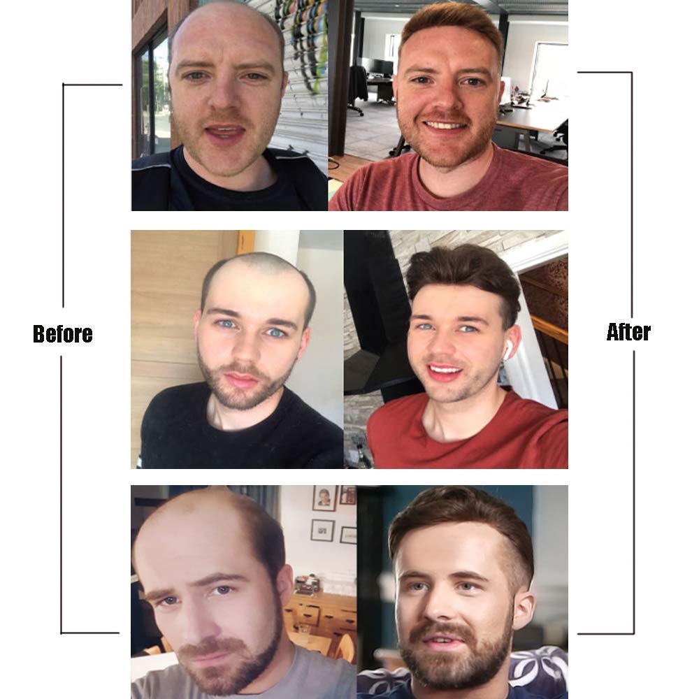 Premium 8x10 Inch Human Hair Toupee for Men - 0.06mm Super Thin Skin Hair System with V-Loop Technology (Dark Light Brown Mixed with 30% Gray) - Natural Looking Hair Replacement for Thinning Hair & Baldness - Perfect for Daily Wear, Special Occasions & Professional Settings