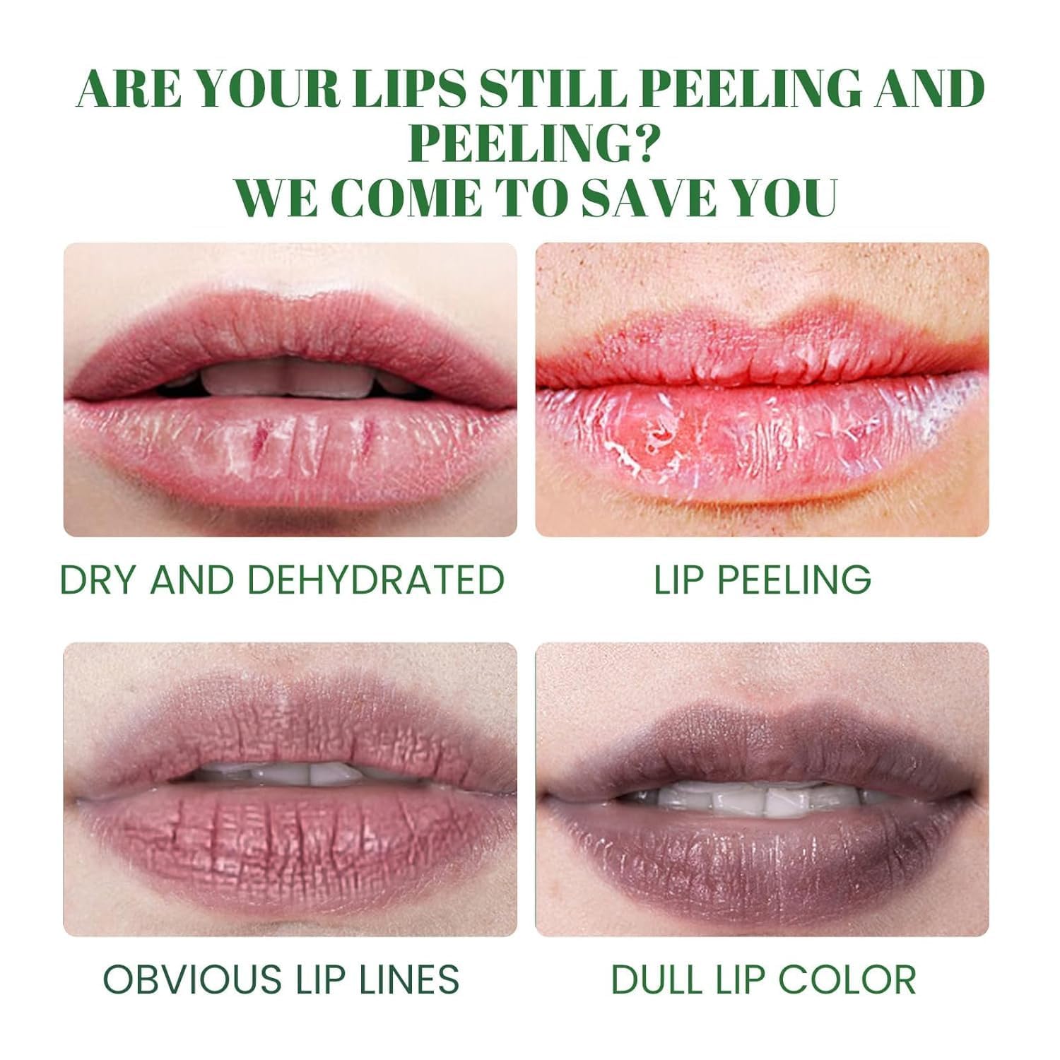 Dark Lip Balm for Lip Lightening & Pigment Removal - Shea Butter Lip Care to Exfoliate Dead Skin & Brighten Dark Lips (3Pcs) - Perfect for Daily Lip Care & Nighttime Treatment