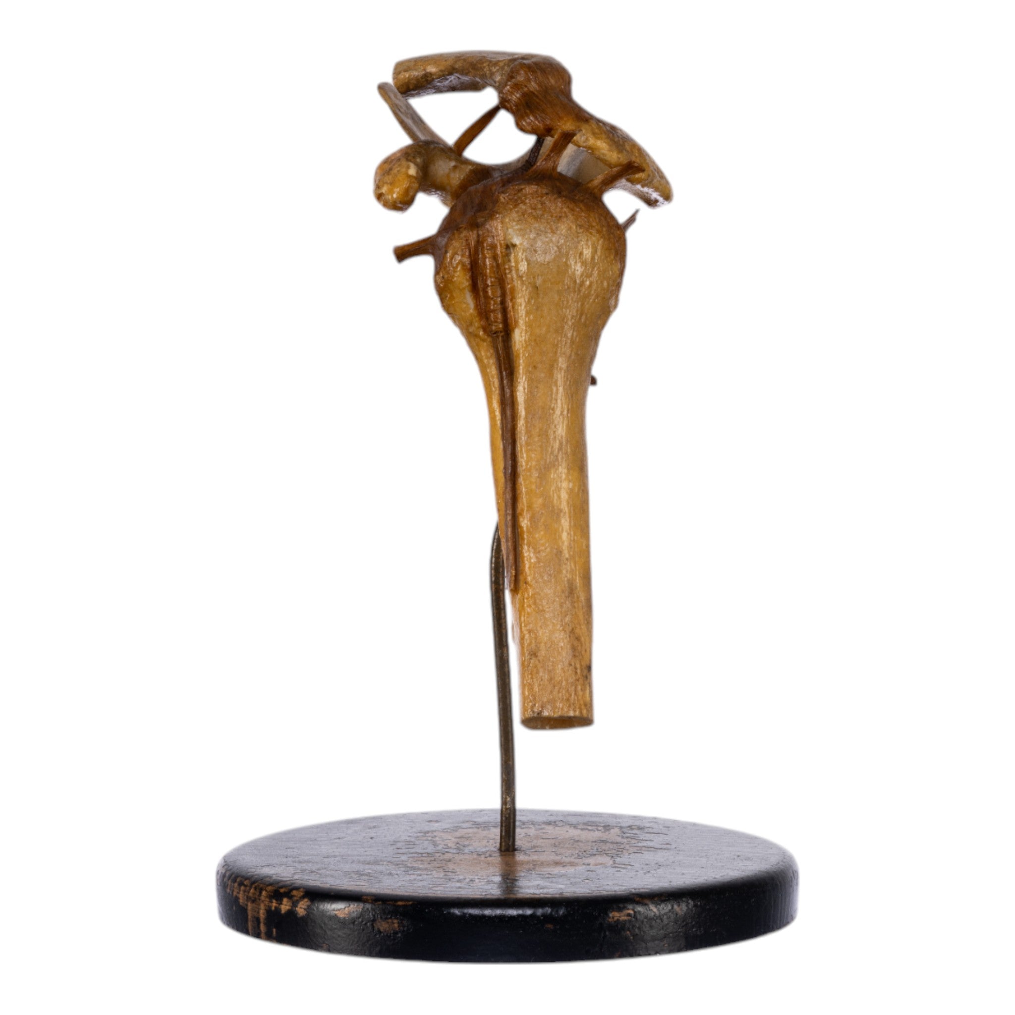 Real Human Left Shoulder Joint Anatomical Model on Stand - Medical Education, Orthopedic Study & Classroom Demonstration