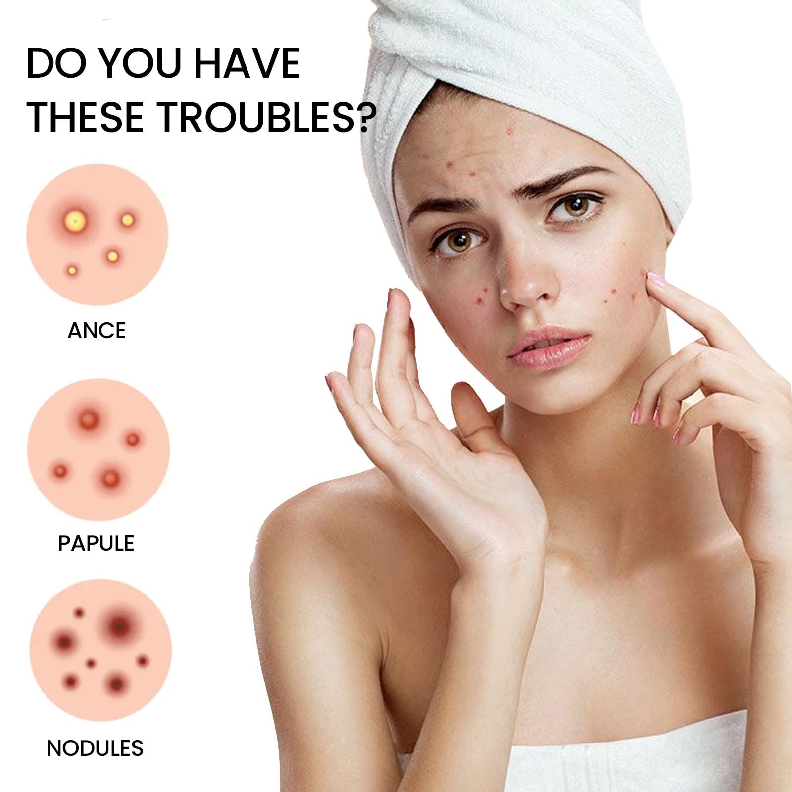 Louatui Star Shaped Hydrocolloid Acne Patches - 400 Pcs Pimple Patches for Face, Zit Absorbing Spot Treatment, Skin Care Stickers (2 Packs) - Perfect for Overnight Acne Treatment & Daily Blemish Cover