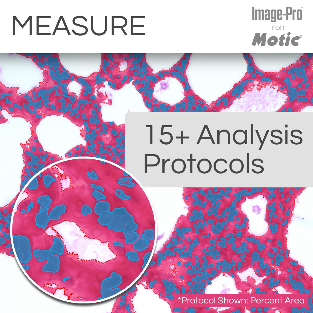 PA53 Clinical & Image Pro® Analysis Package - Professional Skin Analysis Software for Dermatologists & Estheticians - Perfect for Skin Clinics, Spas & Medical Practices