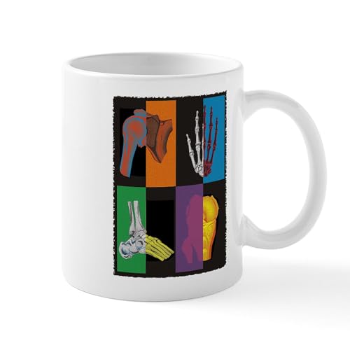 White - Joints Mug