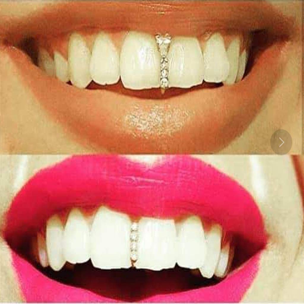 2Pcs 18K Gold Plated Hip Hop Teeth Grillz - Iced Out CZ Gap Grillz for Single Tooth Top or Bottom - Rose Gold Grillz Set for Men & Women - Perfect for Hip Hop Performances, Parties & Fashion Statements