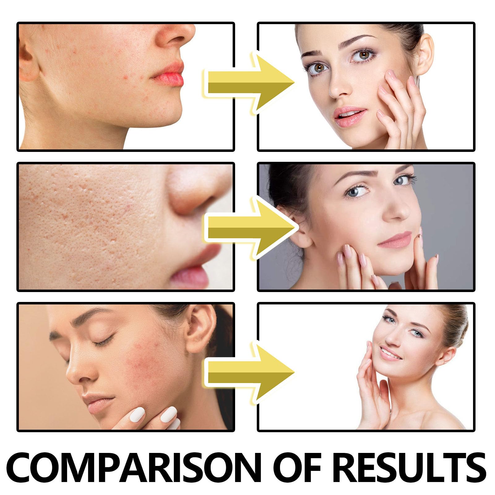 Anti-Aging Bee Venom Facial Gel Moisturizer - Collagen & Hyaluronic Acid Anti-Wrinkle Cream for Firming Skin & Reducing Fine Lines | Day & Night Hydrating Face Care for Youthful Glow