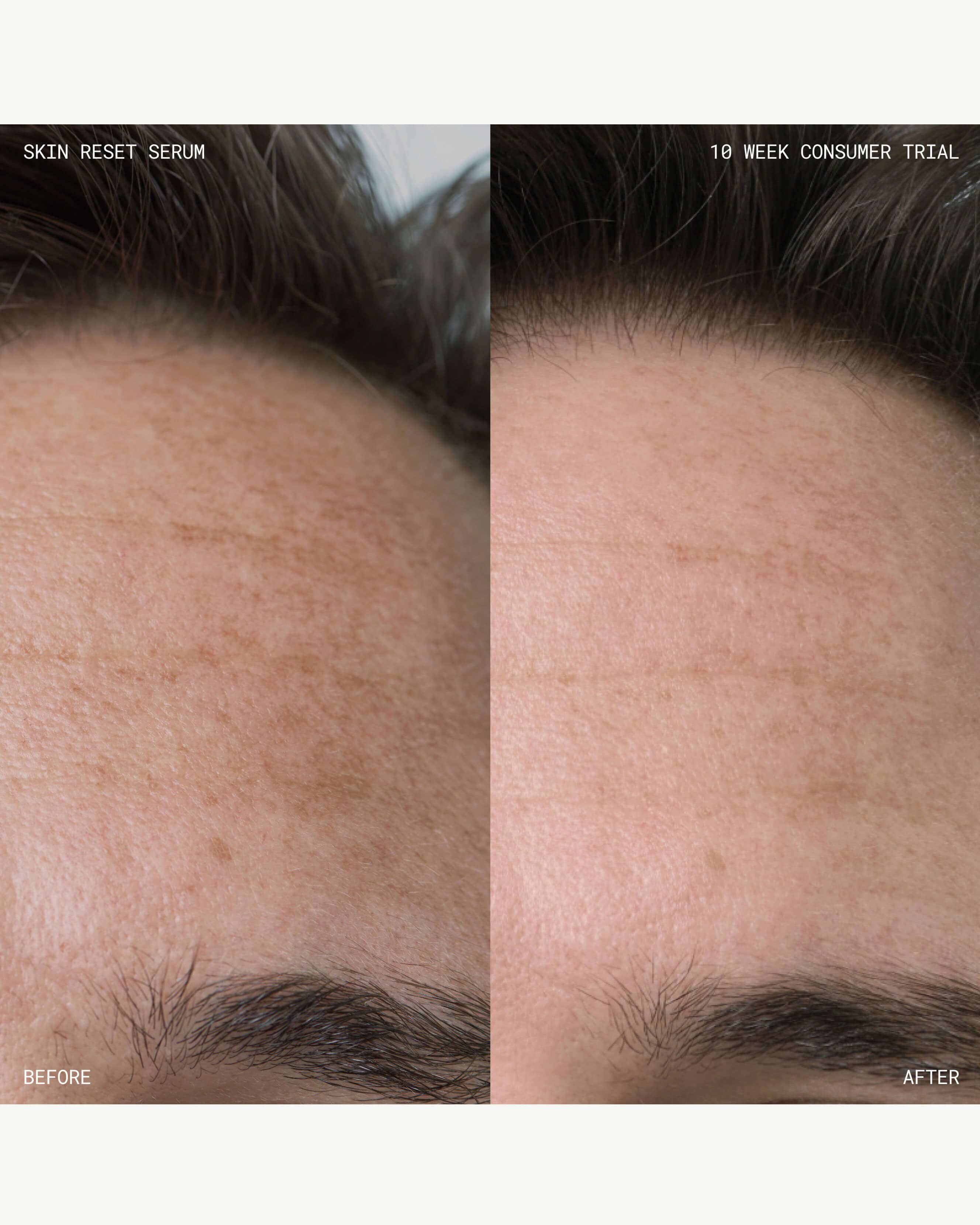 Skin Reset Serum Refill - Anti-Aging Facial Treatment for Glowing Skin | Perfect for Night Routine & Daily Hydration