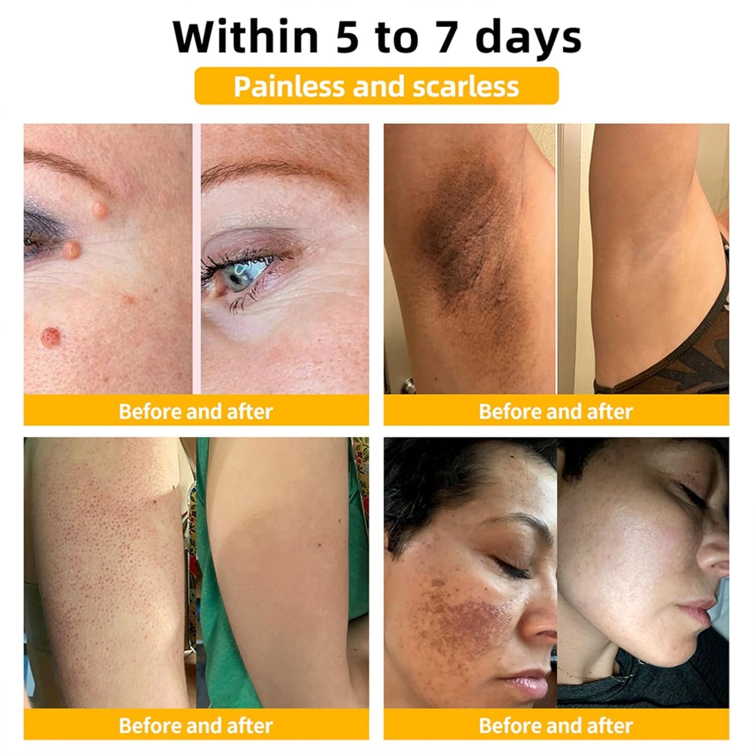 Coenzyme Q10 Collagen Jelly Cream - Intense Moisturizing Skin Care for Daily Use
