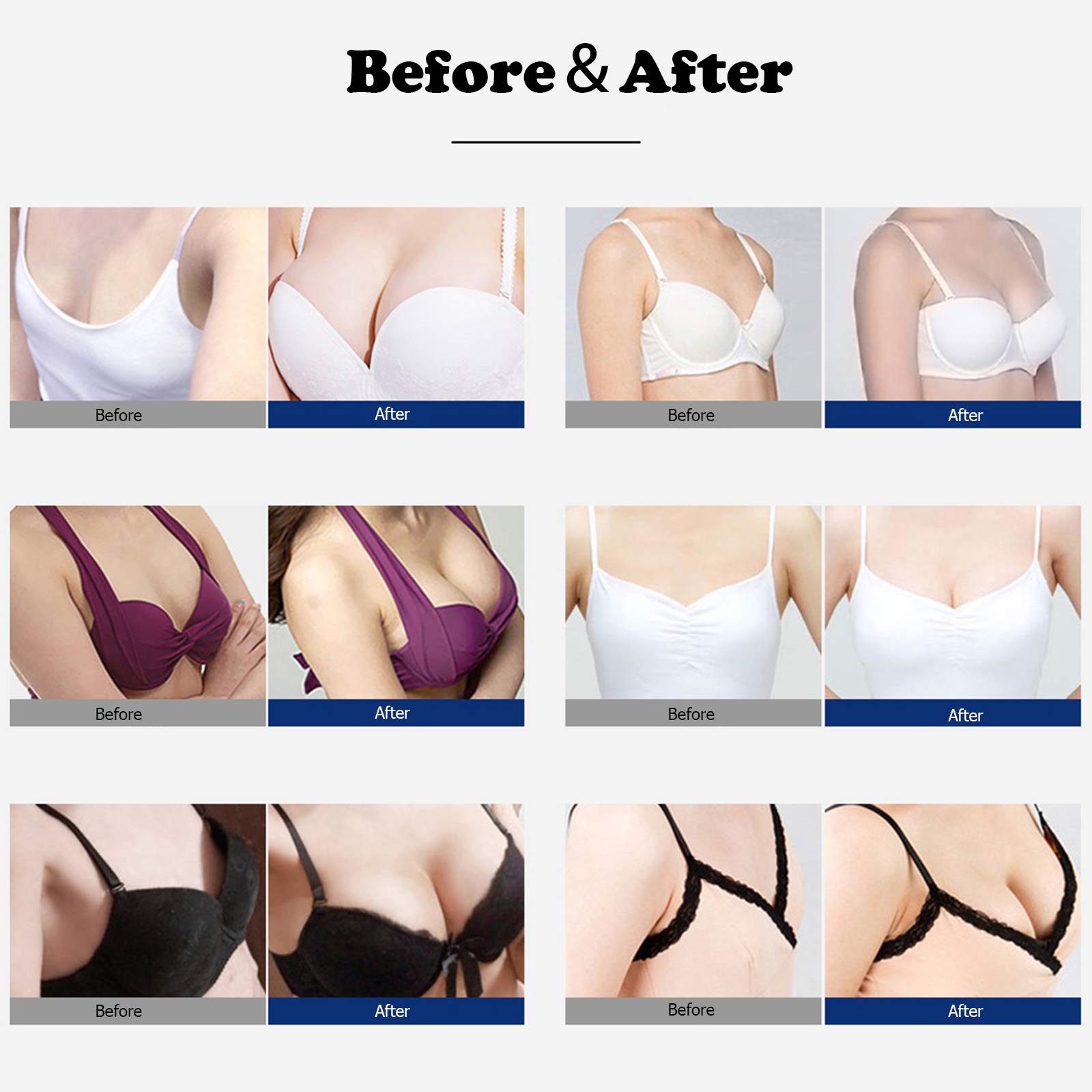 Elitzia Vacuum Cupping Machine for Body Massage & Skin Lifting - Home Use, Anti-Cellulite Therapy