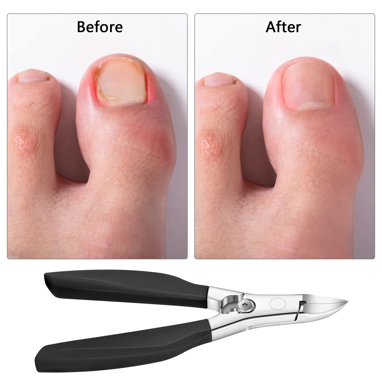 Professional Heavy Duty Toenail Nipper Clippers for Thick & Ingrown Toenails - Stainless Steel Sharp Blades with Long Handle & Lock - Ideal for Seniors, Podiatry & Pedicure Care (Black)