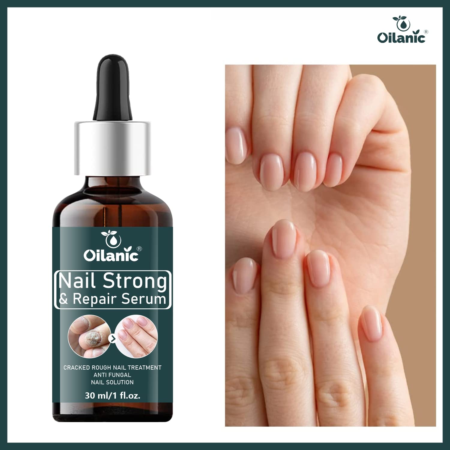 Oilanic Nail Growth Serum - 3 Pack (90ml Total) for Stronger, Shiny Nails & Cuticle Care | Natural Nail Strengthener for Weak, Brittle Nails | Perfect for Manicures, Pedicures & At-Home Nail Care
