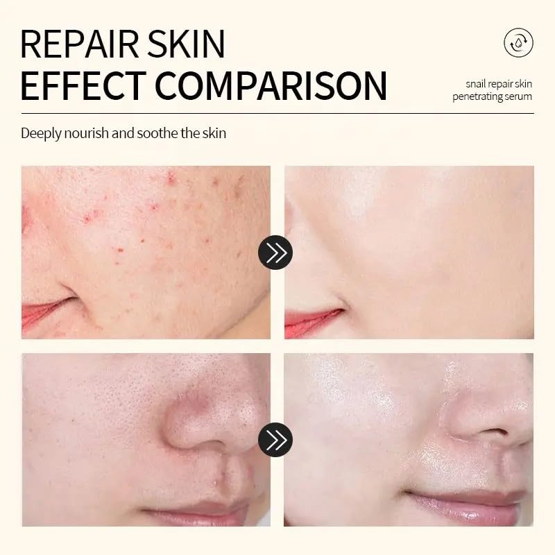 96% Snail Mucin Face Serum for Anti-Aging, Whitening & Skin Repair | Hydrating Facial Essence for Smooth, Radiant Skin | Daily Skincare Routine for Dry & Sensitive Skin