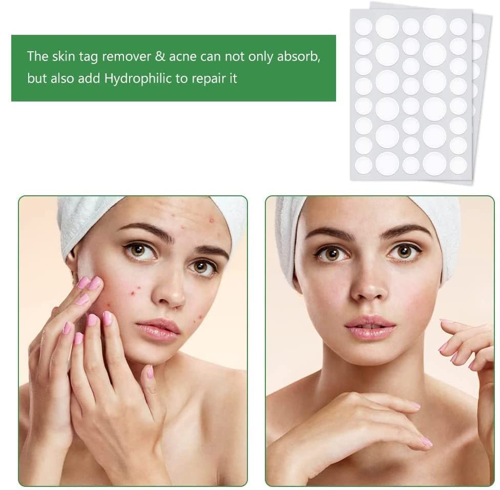 LANELLIE Acne Pimple Patches for Face - 36 Count Invisible Hydrocolloid Spot Treatment Stickers for Blemishes & Breakouts | Fast-Acting Zit Cover & Acne Relief | Perfect for Overnight Use & Daily Skincare Routine