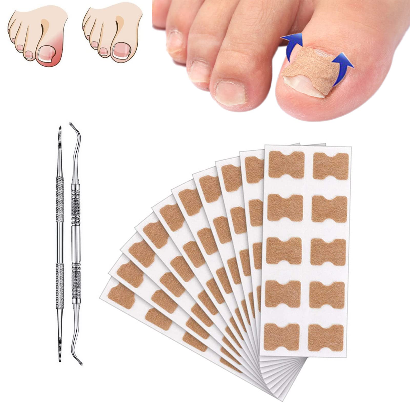 Honey Nirvana Toenail Corrector Patch - Ingrown Toenail Strips for Pain Relief (100pcs) - Home & Travel Care