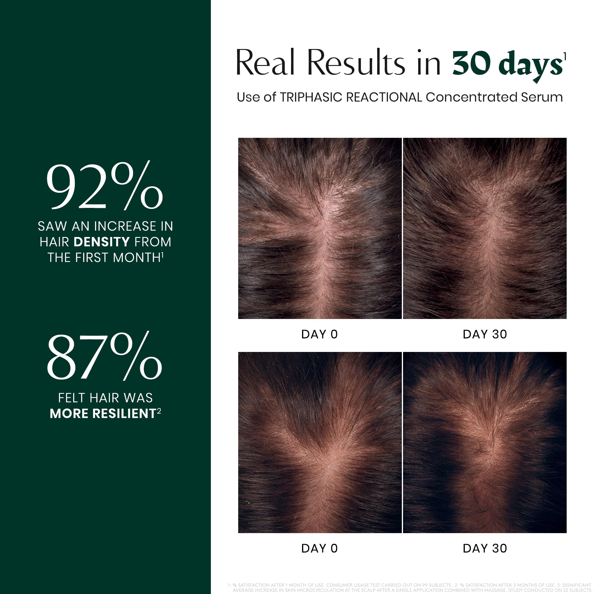 Rene Furterer TRIPHASIC Reactional Thinning Hair Treatment - Strengthening & Volumizing Shampoo for Fine Hair - Perfect for Daily Use & Hair Growth Care