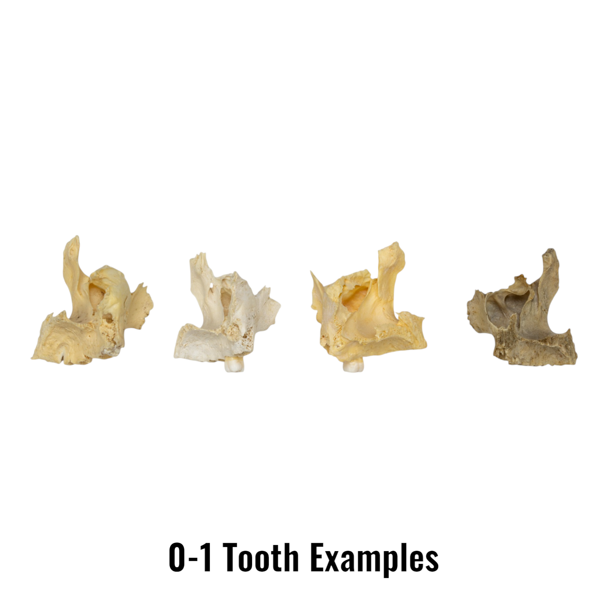 Authentic Human Maxillary Bone - Single Specimen for Medical Study, Dental Education, and Anatomy Research | Ideal for Students, Doctors, and Science Enthusiasts