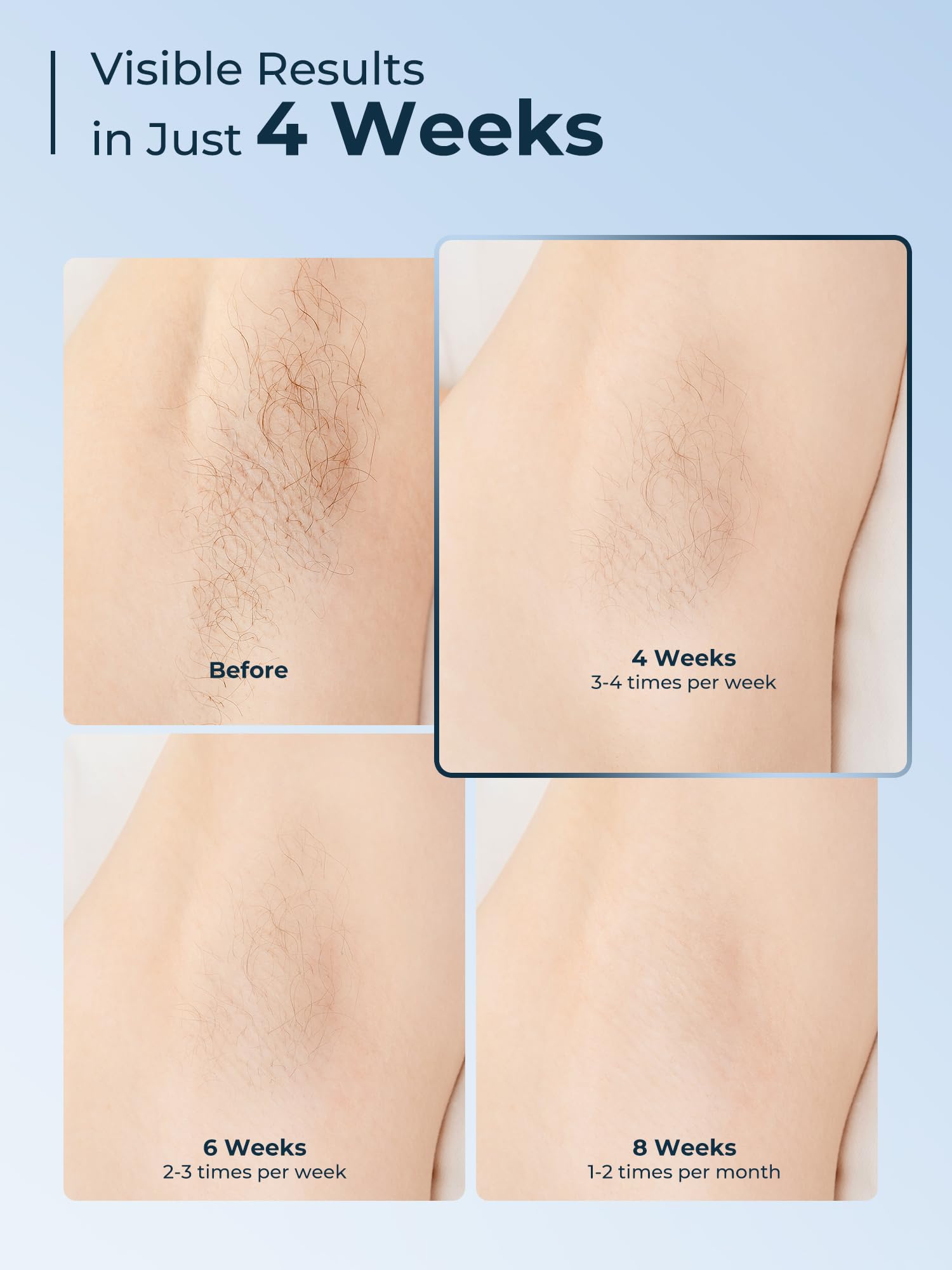 IPL Laser Hair Removal Device for Women & Men - At-Home Permanent Hair Removal with Ice Cooling System, 999,999 Flashes for Painless Full Body Hair Removal | Perfect for Legs, Bikini Line, Underarms & Facial Hair at Home