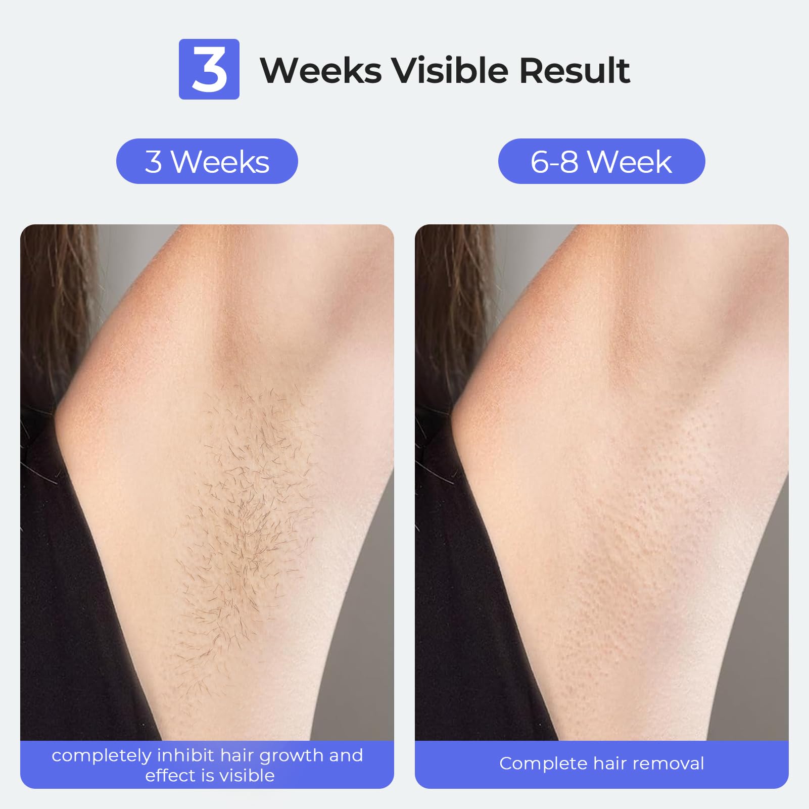 Painless Sapphire Ice Cooling IPL Laser Hair Removal Device for Women & Men - Permanent Hair Reduction, Unlimited Flashes, At-Home Alternative to Salon - Safe for Face, Bikini, Upper Lip, Armpits & Legs - Perfect for Smooth Skin at Home, Travel & Quick Touch-Ups