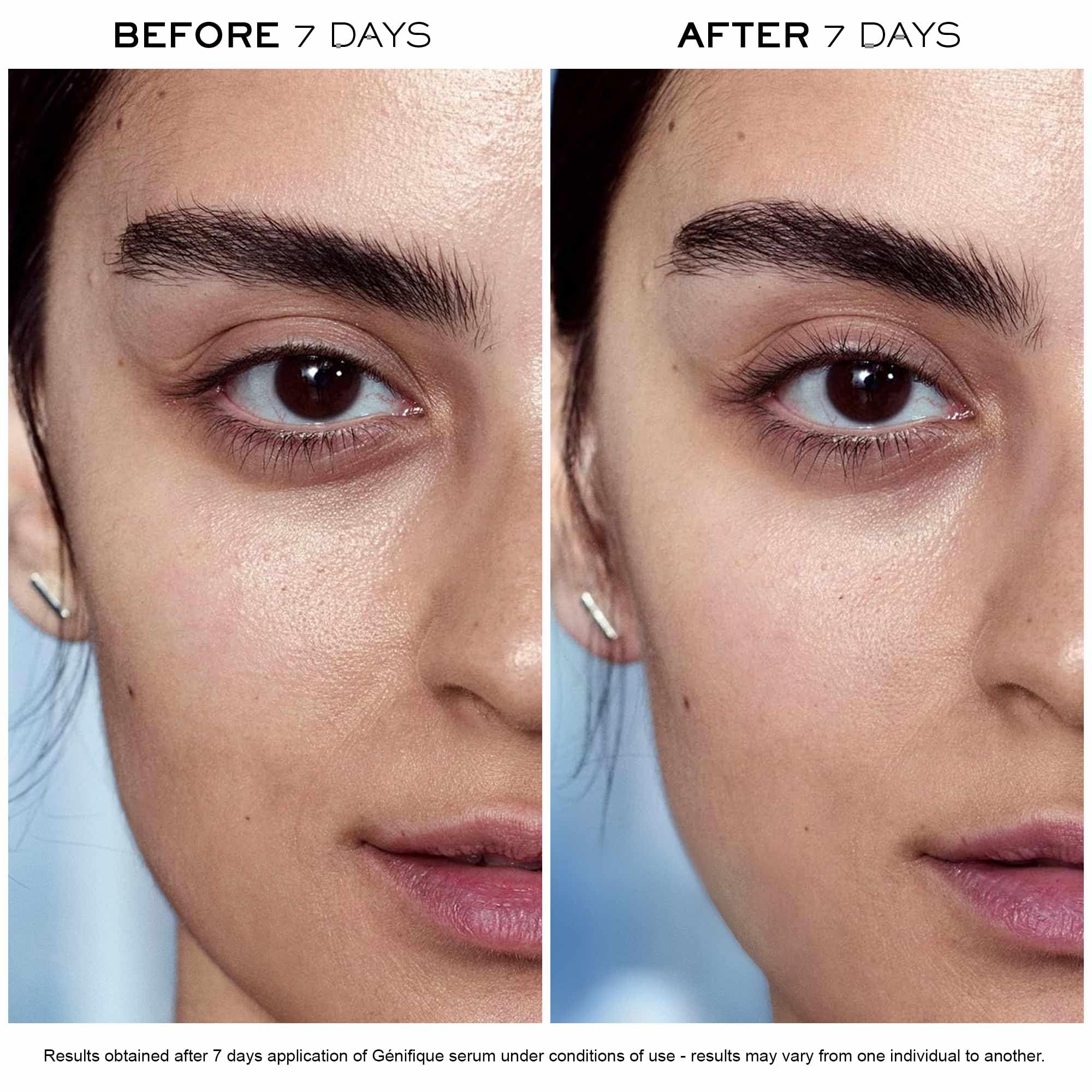 Lancôme Advanced Génifique Anti-Aging Face Serum & Eye Cream Set - Hydrating & Plumping Skincare Duo with Bifidus Prebiotic, Hyaluronic Acid & Vitamin C - Perfect for Nighttime Routine & Travel Skincare Essentials