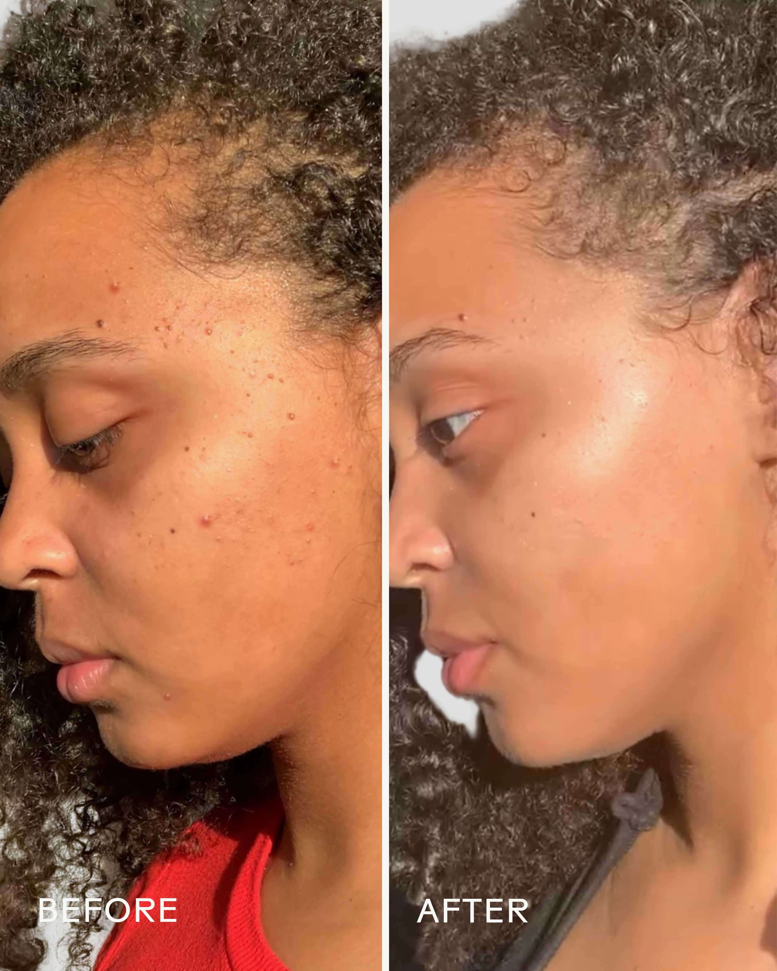 Superfruit Lactic + Multifruit 8% AHA Exfoliating Face Mask - Brightening & Exfoliating Treatment for Glowing Skin - Perfect for Nighttime Skincare Routine