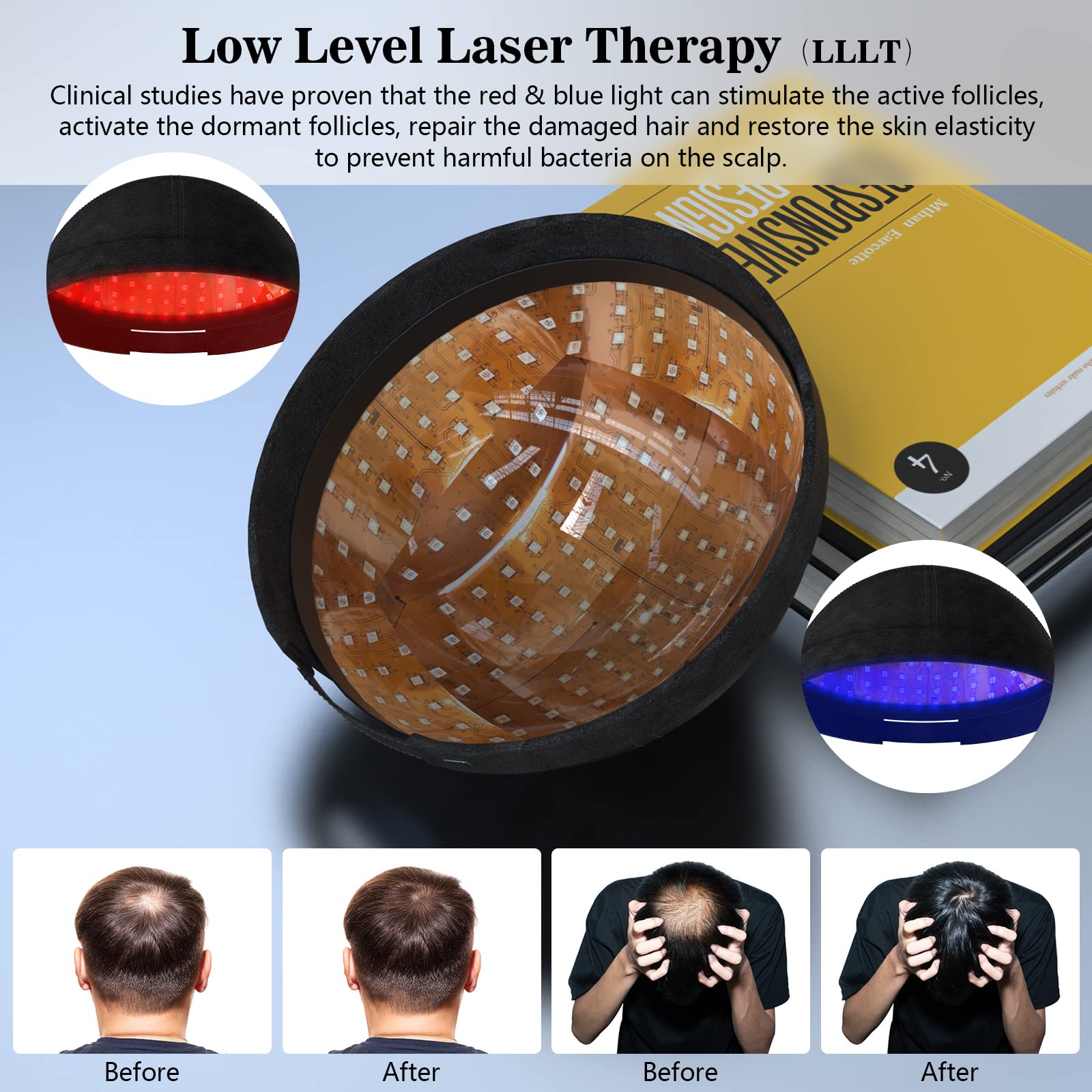 KTS Laser Therapy System for Hair Growth & Regrowth - Hair Loss Treatment Helmet for Men & Women - FDA Cleared for Thinning Hair - At Home Hair Care Solution for Daily Use