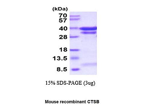 BioVision Inc CTSB Mouse Recombinant Protein (10 micrograms) - High Purity for Research & Lab Use - Ideal for ELISA, Western Blot & Cell Culture Studies