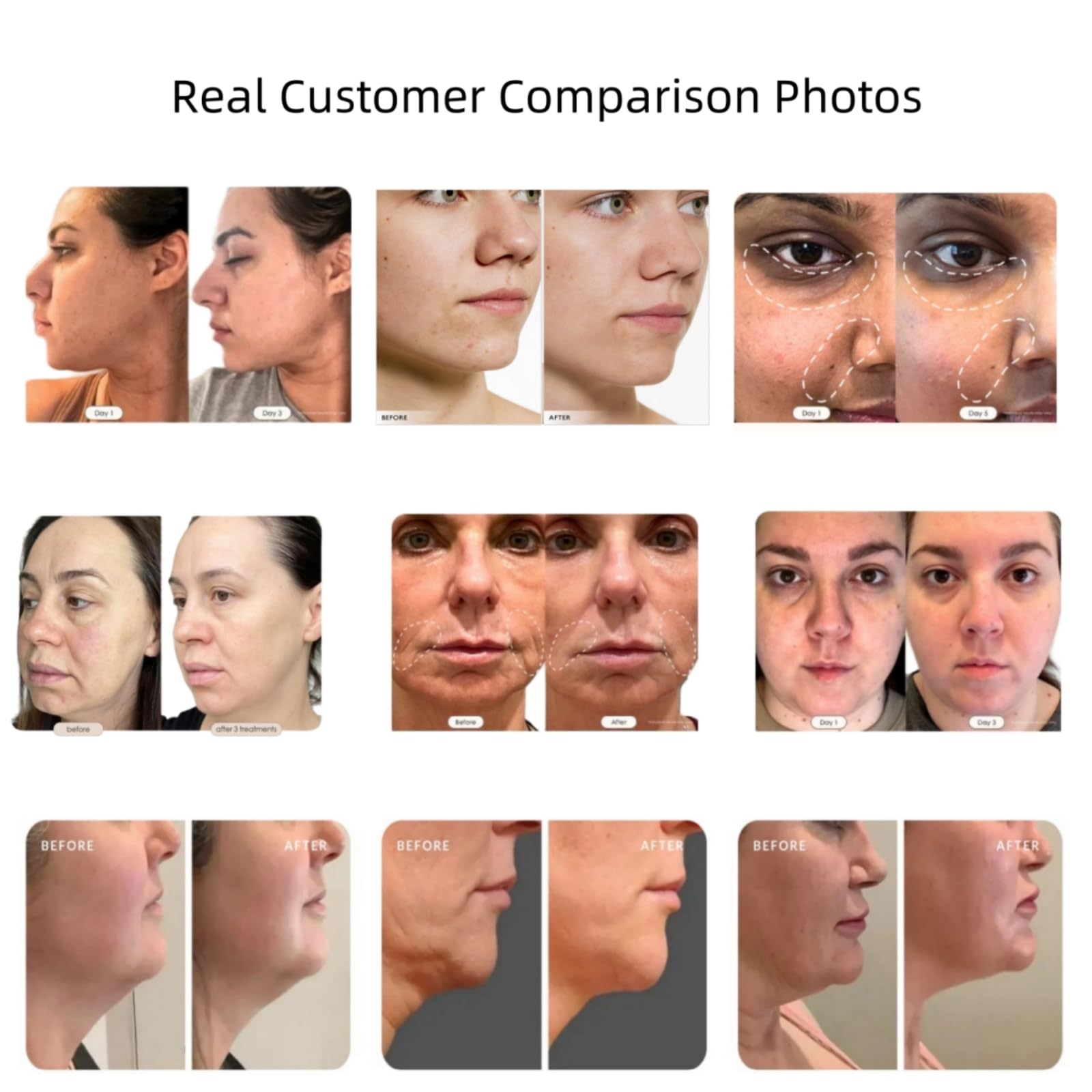 Professional Skin Firming Facial Device for Face & Body - 3 Energy Levels for Salon-Quality Results at Home | Anti-Aging & Wrinkle Reduction Beauty Tool for Daily Skincare Routine