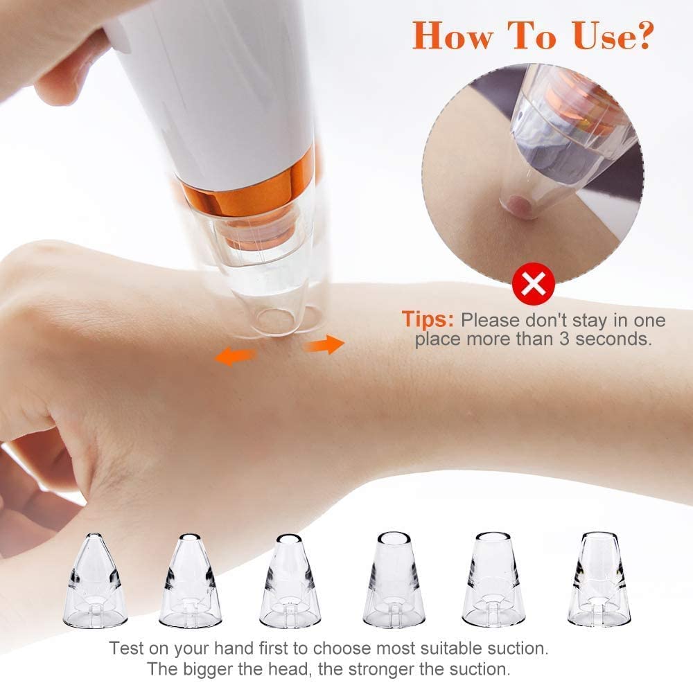 Lukzer Expert Electric Blackhead Remover Vacuum - Professional Derma Suction Tool for Face Cleansing | Men & Women Skincare Device (White) | Perfect for Acne Treatment & Deep Pore Cleaning at Home
