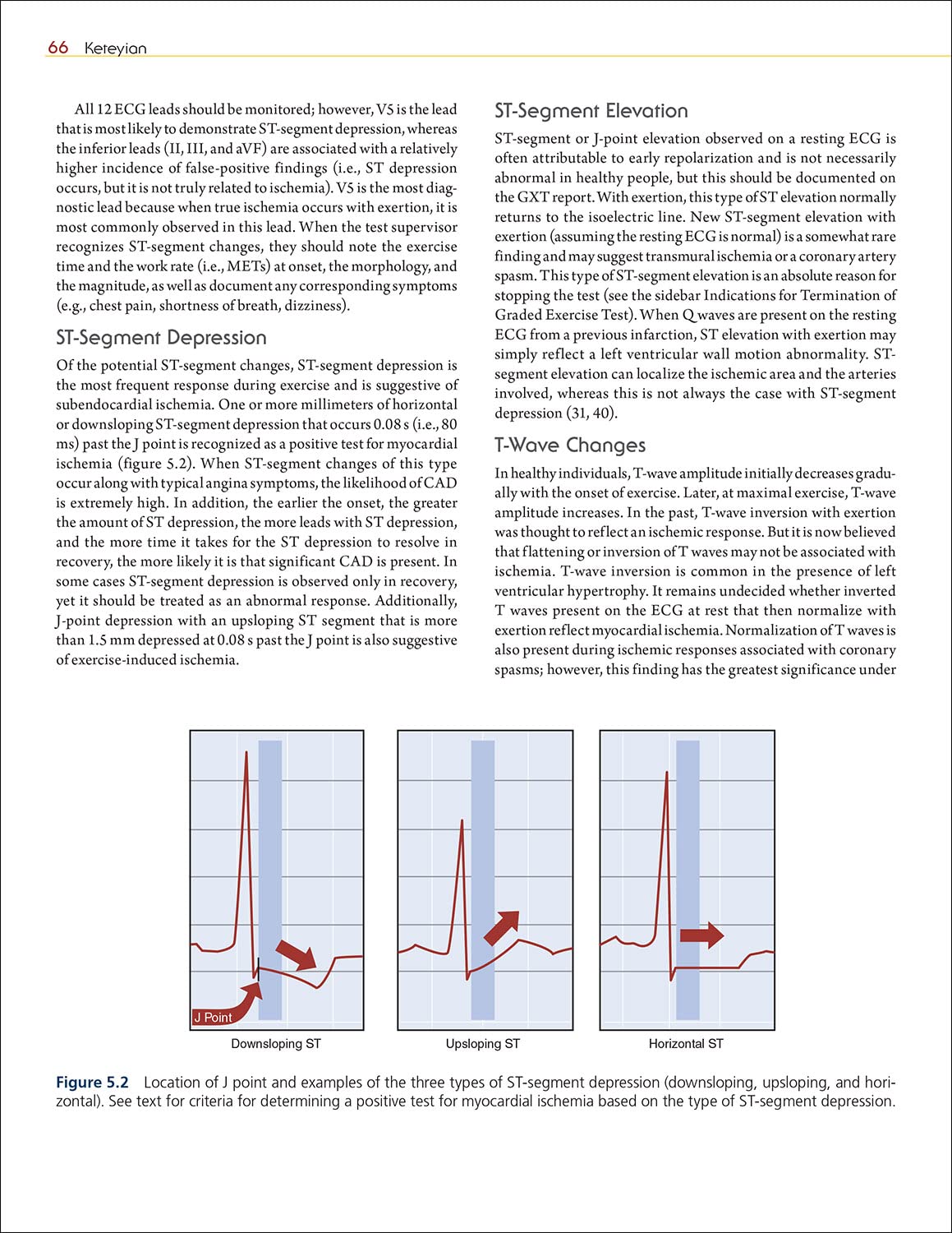 Clinical Exercise Physiology: Exercise Management for Chronic Diseases & Special Populations | Guide for Physical Therapists & Rehabilitation Specialists