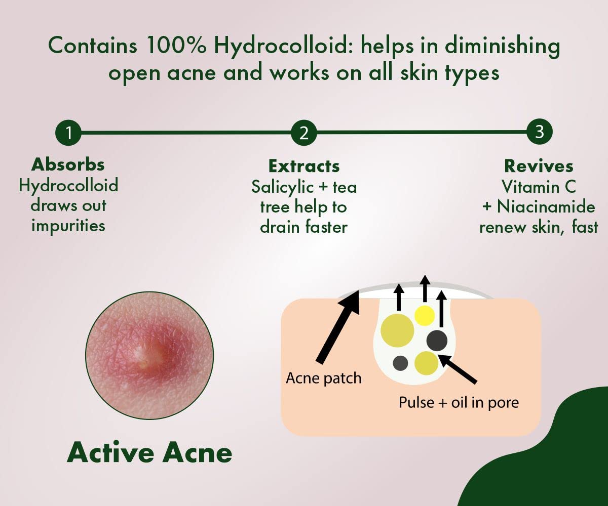 Urban Yog Acne Pimple Patch - Invisible Hydrocolloid Facial Stickers for Acne Treatment (36 Circular Dots) | Perfect for Overnight Spot Treatment & Daily Blemish Cover