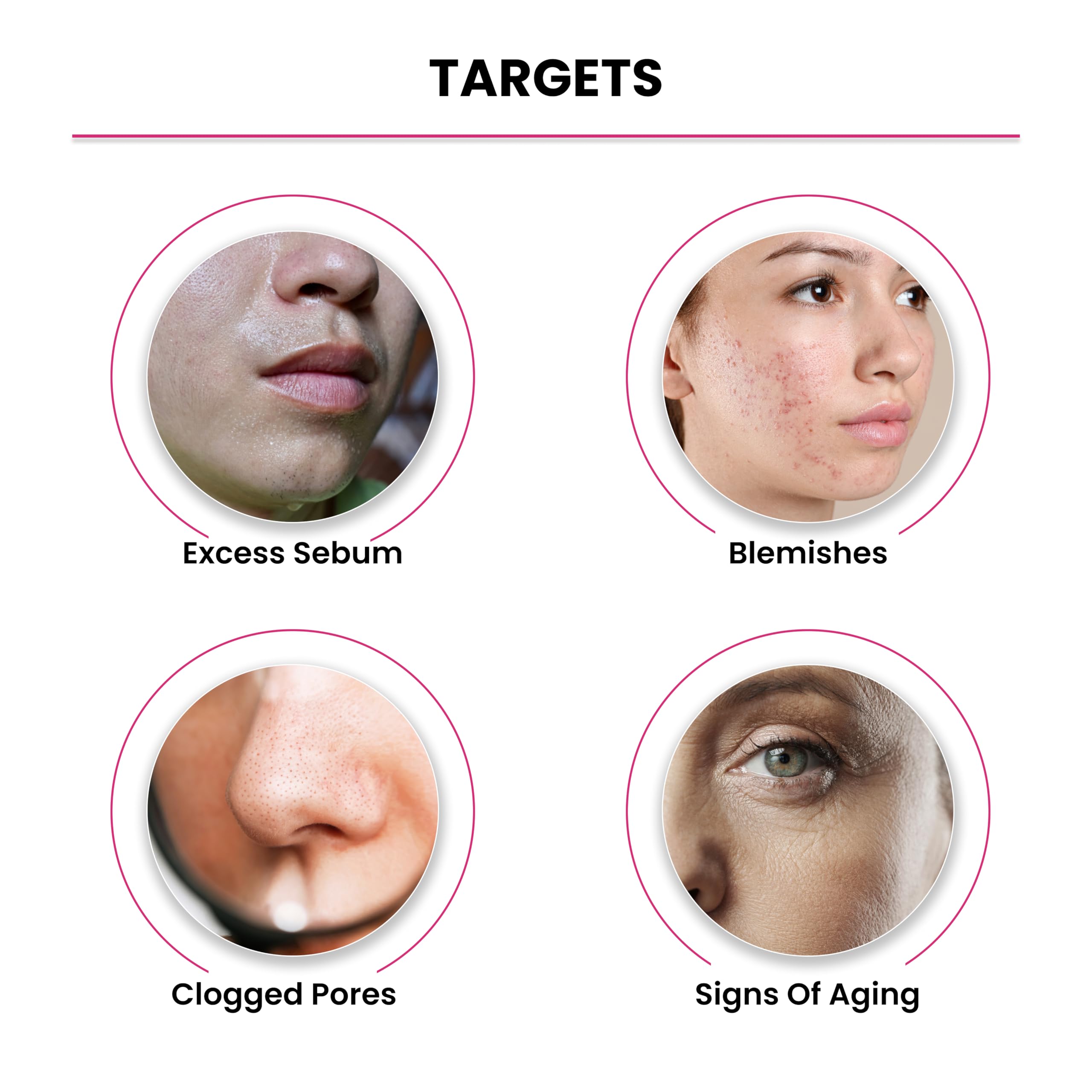 THRIVECO 10% Niacinamide Face Serum with 1% Zinc PCA - Brightening Acne Treatment for Clear, Glowing Skin - 30ml Anti-Blemish Solution for Men & Women - Perfect for Daily Skincare Routine & Acne-Prone Skin Care